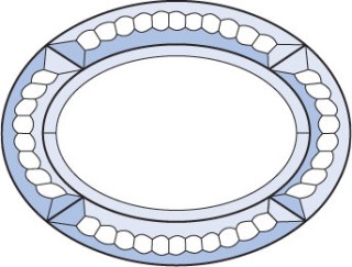 Бевелс AV153 фрамужный (5 элементов) 200 х 152 мм